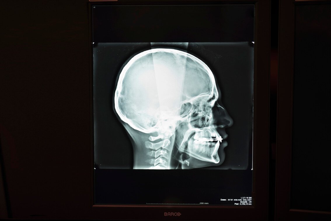 Téléradiographie